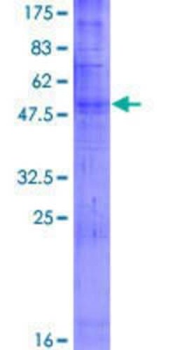 Novus Biologicals Recombinant Human OR52E2 GST (N-Term) Protein 2 &mu;g | Buy Online | Novus Biologicals&trade; | Fisher Scientific