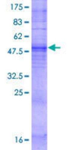 Novus Biologicals Recombinant Human OR5P2 GST (N-Term) Protein 2 &mu;g | Buy Online | Novus Biologicals&trade; | Fisher Scientific