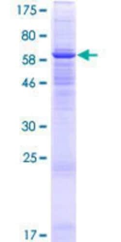 Novus Biologicals Recombinant Human FAM55A GST (N-Term) Protein 25 &mu;g | Buy Online | Novus Biologicals&trade; | Fisher Scientific