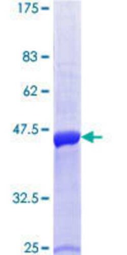 Novus Biologicals Recombinant Human RHEBL1 GST (N-Term) Protein 25 &mu;g | Buy Online | Novus Biologicals&trade; | Fisher Scientific
