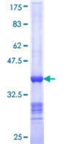 Novus Biologicals&trade;&nbsp;Recombinant Human NEDD1 GST (N-Term) Protein