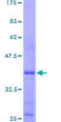Novus Biologicals Recombinant Human Histone H4 GST (N-Term) Protein 2 &mu;g | Buy Online | Novus Biologicals&trade; | Fisher Scientific