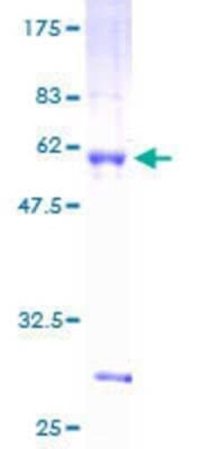 Novus Biologicals Recombinant Human SPIC GST (N-Term) Protein 2 &mu;g | Buy Online | Novus Biologicals&trade; | Fisher Scientific