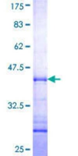 Novus Biologicals Recombinant Human AK7 GST (N-Term) Protein 10 &mu;g | Buy Online | Novus Biologicals&trade; | Fisher Scientific