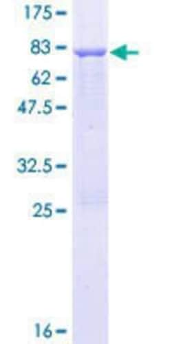 Novus Biologicals Recombinant Human ADSSL1 GST (N-Term) Protein 10 &mu;g | Buy Online | Novus Biologicals&trade; | Fisher Scientific