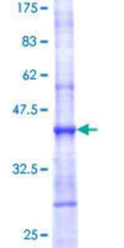 Novus Biologicals Recombinant Human PPIL5 GST (N-Term) Protein 25 &mu;g | Buy Online | Novus Biologicals&trade; | Fisher Scientific