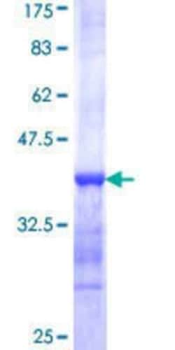 Novus Biologicals Recombinant Human TTC8 GST (N-Term) Protein 10 &mu;g | Buy Online | Novus Biologicals&trade; | Fisher Scientific