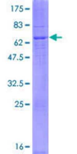 Novus Biologicals&trade;&nbsp;Recombinant Human DEGS2 GST (N-Term) Protein