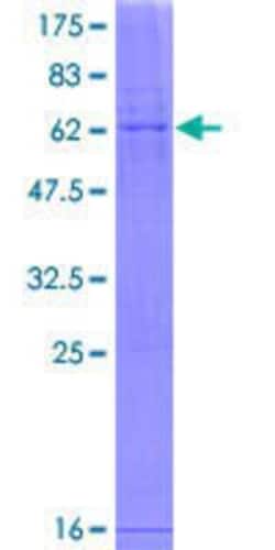 Novus Biologicals Recombinant Human MTFMT GST (N-Term) Protein 25 &mu;g | Buy Online | Novus Biologicals&trade; | Fisher Scientific