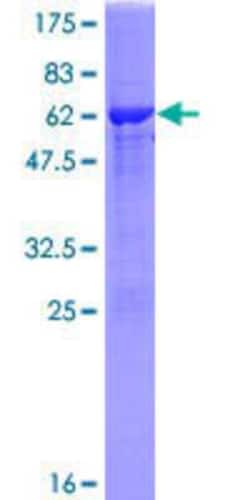 Novus Biologicals Recombinant Human NTAN1 GST (N-Term) Protein 25 &mu;g | Buy Online | Novus Biologicals&trade; | Fisher Scientific