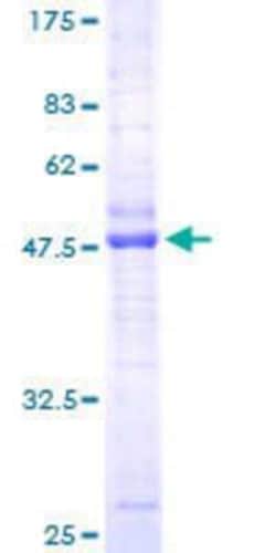 Novus Biologicals Recombinant Human CMTM3 GST (N-Term) Protein 10 &mu;g | Buy Online | Novus Biologicals&trade; | Fisher Scientific