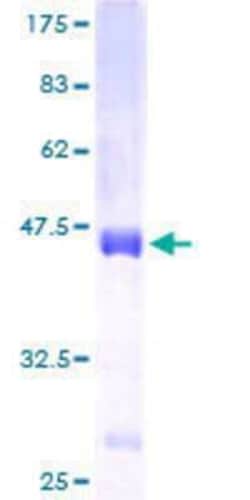 Novus Biologicals Recombinant Human PAUF/ZG16B GST (N-Term) Protein 10 &mu;g | Buy Online | Novus Biologicals&trade; | Fisher Scientific