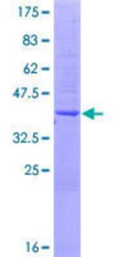 Novus Biologicals Recombinant Human TMPRSS8 GST (N-Term) Protein 10 &mu;g | Buy Online | Novus Biologicals&trade; | Fisher Scientific