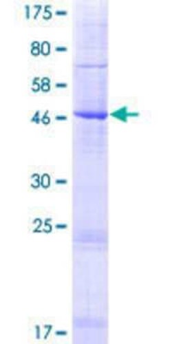 Novus Biologicals Recombinant Human PAQR4 GST (N-Term) Protein 10 &mu;g | Buy Online | Novus Biologicals&trade; | Fisher Scientific