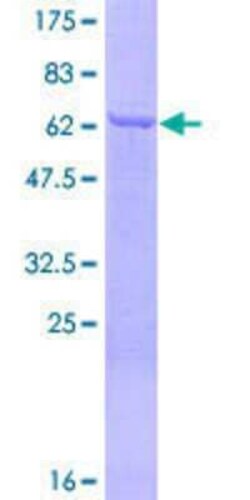 Novus Biologicals Recombinant Human Septin-12 GST (N-Term) Protein 25 &mu;g | Buy Online | Novus Biologicals&trade; | Fisher Scientific