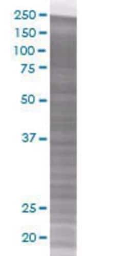 Novus Biologicals Septin-12 293T Cell Transient Overexpression Lysate 0.1 mL | Buy Online | Novus Biologicals&trade; | Fisher Scientific