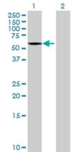 Novus Biologicals&trade;&nbsp;EARS2 293T Cell Transient Overexpression Lysate