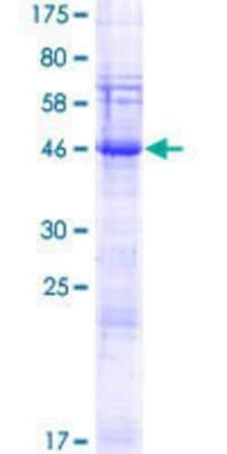 Novus Biologicals&trade;&nbsp;Recombinant Human SPACA3 GST (N-Term) Protein