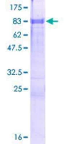 Novus Biologicals Recombinant Human ZFP3 GST (N-Term) Protein 25 &mu;g | Buy Online | Novus Biologicals&trade; | Fisher Scientific