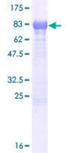 Novus Biologicals Recombinant Human EFCAB13 GST (N-Term) Protein 25 &mu;g | Buy Online | Novus Biologicals&trade; | Fisher Scientific