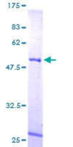 Novus Biologicals Recombinant Human MRPL10 GST (N-Term) Protein 10 &mu;g | Buy Online | Novus Biologicals&trade; | Fisher Scientific
