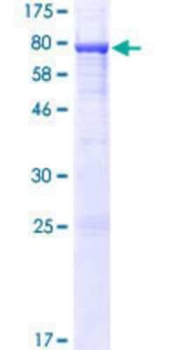 Novus Biologicals Recombinant Human SMCR7 GST (N-Term) Protein 10 &mu;g | Buy Online | Novus Biologicals&trade; | Fisher Scientific