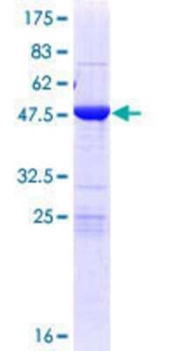 Novus Biologicals Recombinant Human MOBKL2A GST (N-Term) Protein 10 &mu;g | Buy Online | Novus Biologicals&trade; | Fisher Scientific