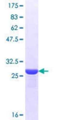 Novus Biologicals Recombinant Human OR1I1 GST (N-Term) Protein 10 &mu;g | Buy Online | Novus Biologicals&trade; | Fisher Scientific