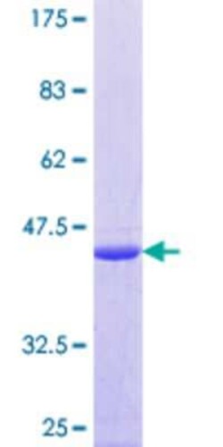 Novus Biologicals Recombinant Human TRA16 GST (N-Term) Protein 10 &mu;g | Buy Online | Novus Biologicals&trade; | Fisher Scientific