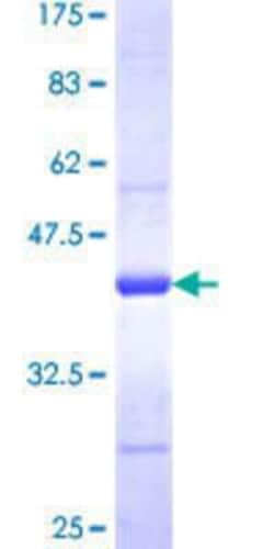 Novus Biologicals Recombinant Human TRA16 GST (N-Term) Protein 10 &mu;g | Buy Online | Novus Biologicals&trade; | Fisher Scientific