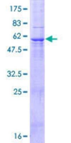 Novus Biologicals Recombinant Human FBXO27 GST (N-Term) Protein 10 &mu;g | Buy Online | Novus Biologicals&trade; | Fisher Scientific