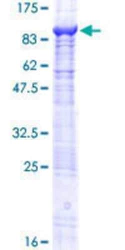 Novus Biologicals Recombinant Human Basalin GST (N-Term) Protein 10 &mu;g | Buy Online | Novus Biologicals&trade; | Fisher Scientific