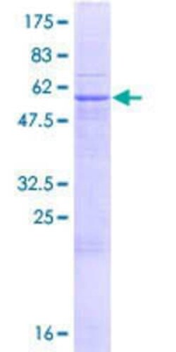 Novus Biologicals Recombinant Human PUSL1 GST (N-Term) Protein 10 &mu;g | Buy Online | Novus Biologicals&trade; | Fisher Scientific