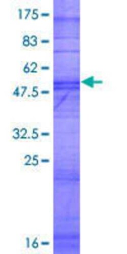 Novus Biologicals Recombinant Human OR2T10 GST (N-Term) Protein 2 &mu;g | Buy Online | Novus Biologicals&trade; | Fisher Scientific