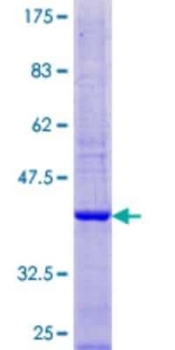 Novus Biologicals Recombinant Human ATP6V1G3 GST (N-Term) Protein 10 &mu;g | Buy Online | Novus Biologicals&trade; | Fisher Scientific