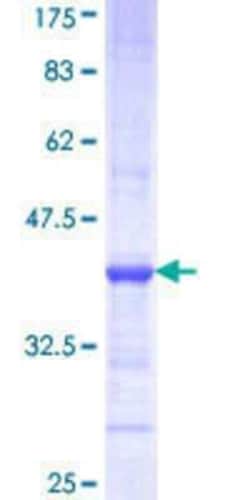 Novus Biologicals Recombinant Human ATP6V1G3 GST (N-Term) Protein 25 &mu;g | Buy Online | Novus Biologicals&trade; | Fisher Scientific