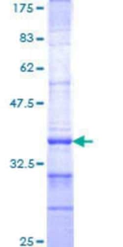 Novus Biologicals Recombinant Human OTX3 GST (N-Term) Protein 10 &mu;g | Buy Online | Novus Biologicals&trade; | Fisher Scientific