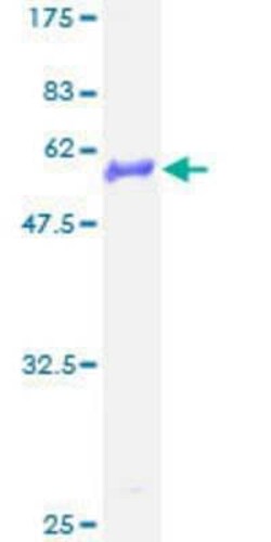 Novus Biologicals Recombinant Human Connexin 30.3/GJB4 GST (N-Term) Protein 2 &mu;g | Buy Online | Novus Biologicals&trade; | Fisher Scientific