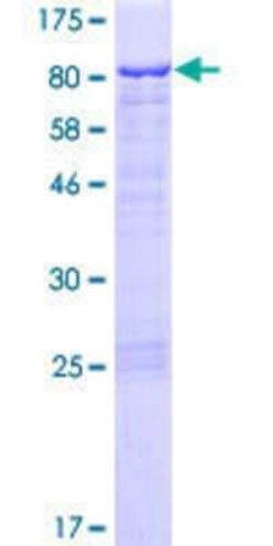 Novus Biologicals Recombinant Human C1orf87 GST (N-Term) Protein 25 &mu;g | Buy Online | Novus Biologicals&trade; | Fisher Scientific
