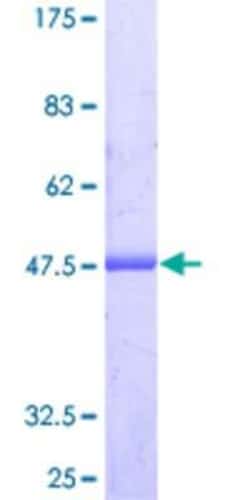 Novus Biologicals Recombinant Human ARL8A GST (N-Term) Protein 10 &mu;g | Buy Online | Novus Biologicals&trade; | Fisher Scientific