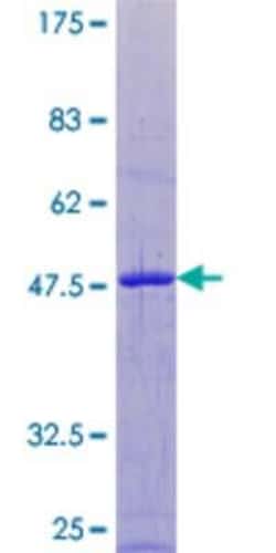 Novus Biologicals Recombinant Human ARL8A GST (N-Term) Protein 25 &mu;g | Buy Online | Novus Biologicals&trade; | Fisher Scientific