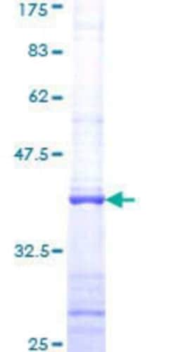 Novus Biologicals Recombinant Human KIST GST (N-Term) Protein 25 &mu;g | Buy Online | Novus Biologicals&trade; | Fisher Scientific