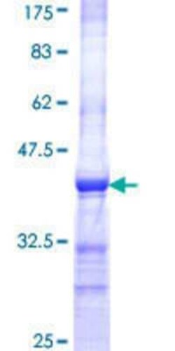 Novus Biologicals Recombinant Human IQGAP3 GST (N-Term) Protein 10 &mu;g | Buy Online | Novus Biologicals&trade; | Fisher Scientific