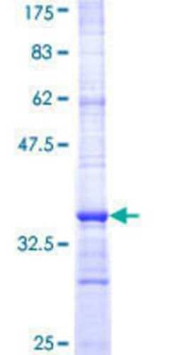 Novus Biologicals Recombinant Human PIGU GST (N-Term) Protein 25 &mu;g | Buy Online | Novus Biologicals&trade; | Fisher Scientific