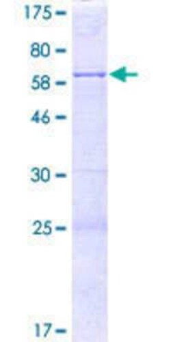Novus Biologicals Recombinant Human KLRAQ1 GST (N-Term) Protein 2 &mu;g | Buy Online | Novus Biologicals&trade; | Fisher Scientific