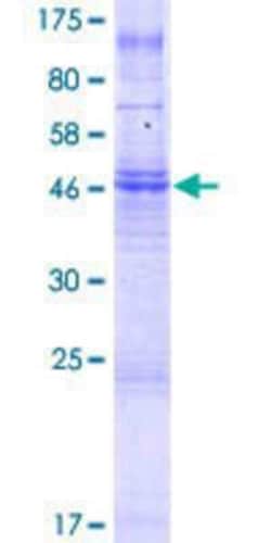Novus Biologicals&trade;&nbsp;Recombinant Human TMEM150A GST (N-Term) Protein