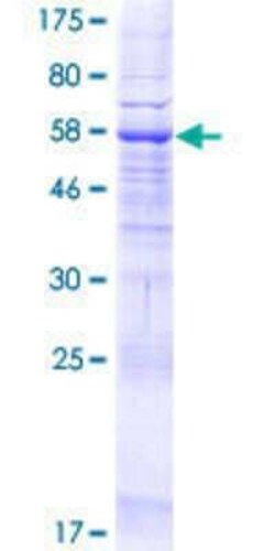 Novus Biologicals Recombinant Human MBOAT2 GST (N-Term) Protein 25 &mu;g | Buy Online | Novus Biologicals&trade; | Fisher Scientific