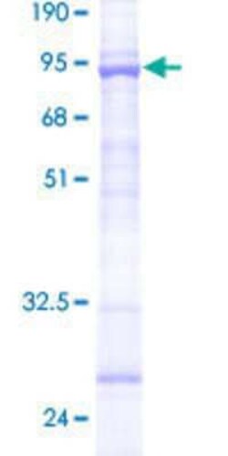 Novus Biologicals Recombinant Human TRIM43 GST (N-Term) Protein 25 &mu;g | Buy Online | Novus Biologicals&trade; | Fisher Scientific