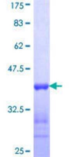 Novus Biologicals Recombinant Human ACMSD GST (N-Term) Protein 25 &mu;g | Buy Online | Novus Biologicals&trade; | Fisher Scientific