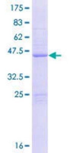 Novus Biologicals Recombinant Human CIB4 GST (N-Term) Protein 10 &mu;g | Buy Online | Novus Biologicals&trade; | Fisher Scientific
